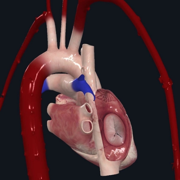 Corazon base